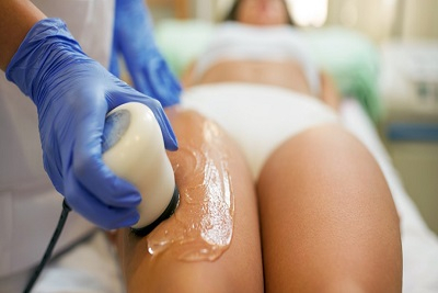 10 anticelulit masža + 5 shockwave terapija, popust