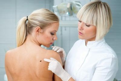 Pregled dermatologa i dermatoskopija svih mladeža po telu | Akcija